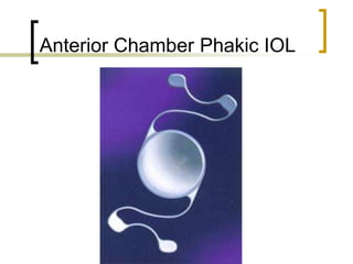 Anterior Chamber Phakic IOL
 