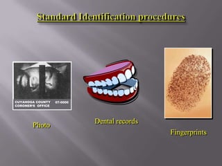 CUYAHOGA COUNTY    07-0000
CORONER‘S OFFICE




                             Dental records
        Photo
                                              Fingerprints
 