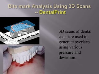 3D scans of dental
casts are used to
generate overlays
using various
pressure and
deviation.
 