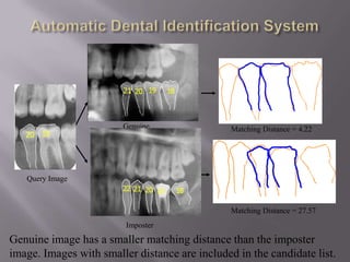 Genuine                 Matching Distance = 4.22




   Query Image



                                                Matching Distance = 27.57
                         Imposter
Genuine image has a smaller matching distance than the imposter
image. Images with smaller distance are included in the candidate list.
 