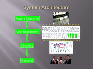 Feature Extraction
                     1    2   3   4 5   6 7 8   9 10 11 1213 14 15 16




Atlas Registration

                     32   31 30 29 28 27 2625 2423 22 21 20 19   18 17



    Matching



    Retrieval
 