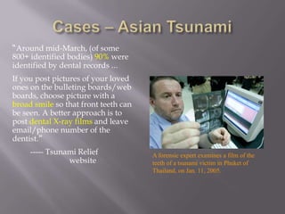 “Around mid-March, (of some
800+ identified bodies) 90% were
identified by dental records …
If you post pictures of your loved
ones on the bulleting boards/web
boards, choose picture with a
broad smile so that front teeth can
be seen. A better approach is to
post dental X-ray films and leave
email/phone number of the
dentist.”
     ----- Tsunami Relief             A forensic expert examines a film of the
                website               teeth of a tsunami victim in Phuket of
                                      Thailand, on Jan. 11, 2005.
 