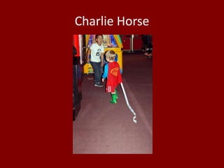 Charlie Horse
 