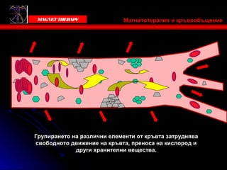Victoria Bells
   MAGNET THER Y
              AP             Магнитотерапия и кръвообъщение




 Групирането на различни елементи от кръвта затруднява
 свободното движение на кръвта, преноса на кислород и
              други хранителни вещества.
 