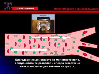 Victoria Bells
   MAGNET THER Y
              AP           Магнитотерапия и кръвообръщение




 Благодарение действието на магнитното поле,
 еритроцитите се разделят и следва естествено
    възстановяване движението на кръвта.
 