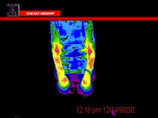 Victoria Bells
  MAGNET THER Y
             AP
 