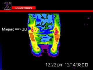 Victoria Bells
  MAGNET THER Y
             AP
 