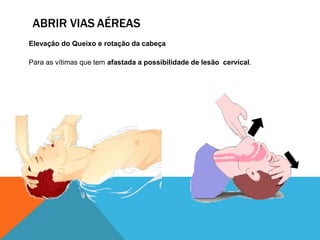ABRIR VIAS AÉREAS
Elevação do Queixo e rotação da cabeça
Para as vítimas que tem afastada a possibilidade de lesão cervical.
 