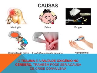 CAUSAS
Meningite Febre Drogas
Desidratação grave Insuficiência renal avançada Hipoglicemia
O TRAUMA E A FALTA DE OXIGÊNIO NO
CÉREBRO, TRAMBÉM PODE SER ACAUSA
DE CRISE CONVULSIVA
 