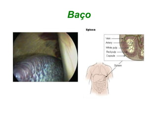 Baço
 