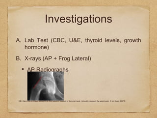 Investigations
A. Lab Test (CBC, U&E, thyroid levels, growth
hormone)
B. X-rays (AP + Frog Lateral)
• AP Radiographs
NB. Klein line is drawn straight up the superior aspect of femoral neck. (should intersect the epiphysis), if not likely SUFE.
 