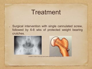 Treatment
Surgical intervention with single cannulated screw,
followed by 6-8 wks of protected weight bearing
crutches.
Unstable or Grade III slips may require gentle repositioning to improve alignment
 