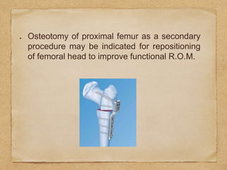 Osteotomy of proximal femur as a secondary
procedure may be indicated for repositioning
of femoral head to improve functional R.O.M.
 