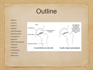 Outline
Definition
Anatomy
Incidence
Aetiology
Pathophysiology
Signs/Symptoms
Investigations
Diagnosis
Differential Diagnosis
Treatment
Prognosis
Complications
Conclusion
References
 