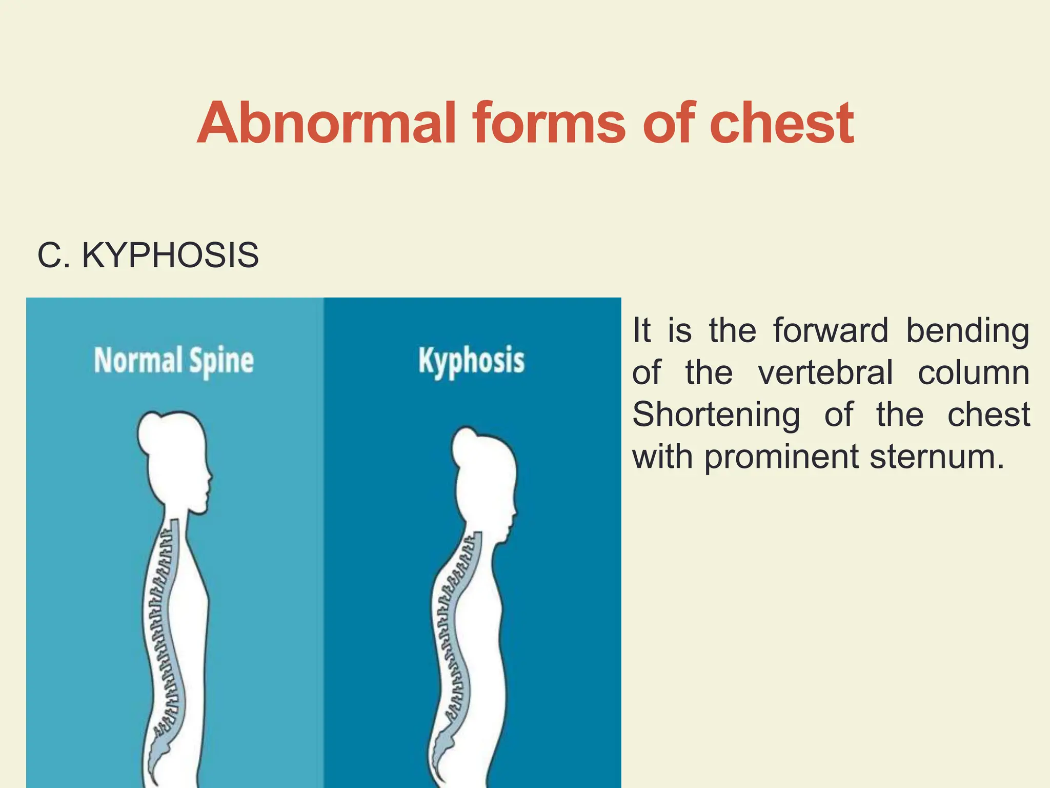 498485741-Respiratory-System-Examination.pptx