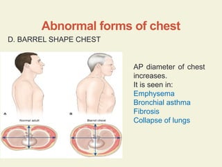 498485741-Respiratory-System-Examination.pptx