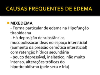  MIXEDEMA
- Forma particular de edema na Hipofunção
tireoideana
- Há deposição de substâncias
mucopolissacarídeas no espaço intersticial
(aumento da pressão osmótica intersticial)
com retenção hídrica secundária
- pouco depressível, inelástico, não muito
intenso, alterações tróficas do
hipotireoidismo (pele seca e fria)
 