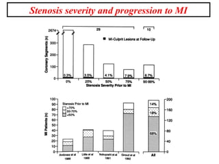 Stenosis severity and progression to MI
 