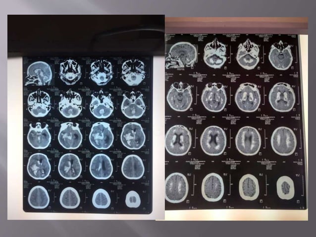 4a. Bimbingan Neuroimaging CT Scan Kepala - Residen.pptx