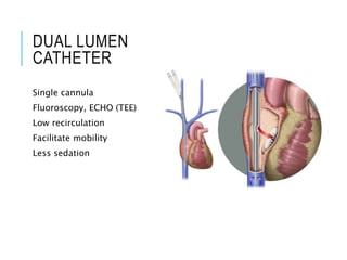 DUAL LUMEN
CATHETER
Single cannula
Fluoroscopy, ECHO (TEE)
Low recirculation
Facilitate mobility
Less sedation
 