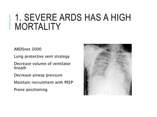 1. SEVERE ARDS HAS A HIGH
MORTALITY
ARDSnet 2000
Lung protective vent strategy
Decrease volume of ventilator
breath
Decrease airway pressure
Maintain recruitment with PEEP
Prone positioning
 