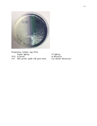 1A5
Pseudomonas Isolation Agar (PIA)
Regular lighting: UV lighting:
1E10 no growth no fluorescein
1A5 thick growth- purple with green smear very minimal fluorescence
 