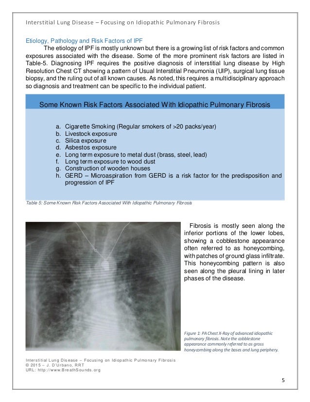 Interstitial Lung Disease Focusing on Idiopathic