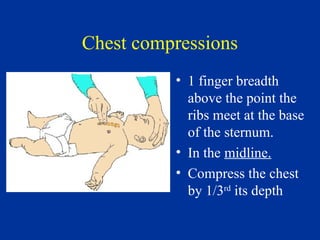 What Is Rib Compression 4 Airway, Breathing and Circulation paeds.ppt