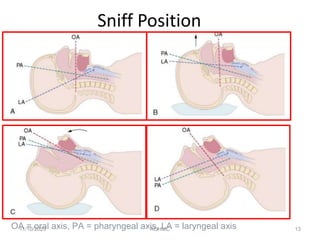 4 Airway management andOxygen delivery interfaces.pptx