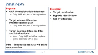 Page 11
Physical
• OAR volume/position difference
– Daily IGRT with plan of the day options
• Target volume difference
Interfractional re-plan
– Daily IGRT with plan of the day options
• Target position difference Inter
and intrafractional
– Inter - Daily IGRT and offline re-plans
– Online dosimetry with re-plan
Intra – Intrafractional IGRT wit online
compensation
What next?
Biological
• Target Localisation
• Hypoxia Identification
• Cell Proliferation
 