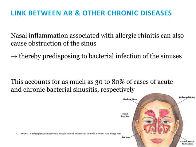 4 Allergic Rhinitis & URTI Allergic rhinitis – definition Burden and ...