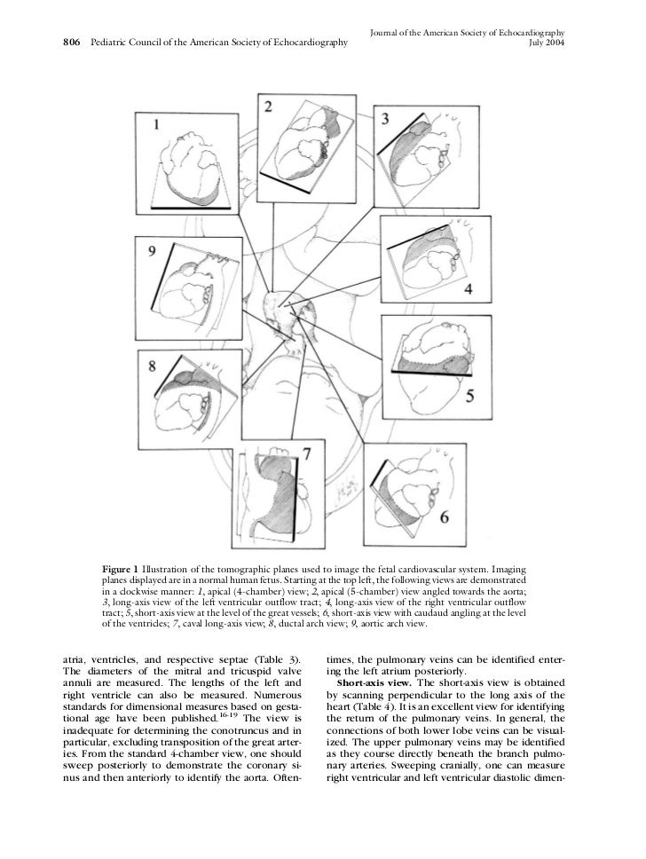 Pediatric Echo Report Template Pediatric Echo Report Template