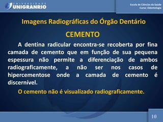 Escola de Ciências da Saúde
Curso: Odontologia
Imagens Radiográficas do Órgão Dentário
CEMENTO
A dentina radicular encontra-se recoberta por fina
camada de cemento que em função de sua pequena
espessura não permite a diferenciação de ambos
radiograficamente, a não ser nos casos de
hipercementose onde a camada de cemento é
discernível.
O cemento não é visualizado radiograficamente.
10
 