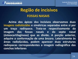 Escola de Ciências da Saúde
Curso: Odontologia
Região de incisivos
FOSSAS NASAIS
Acima dos ápices dos incisivos observamos duas
imagens radiolúcidas e simétricas separadas entre si por
um traço radiopaco. Trata-se respectivamente da
imagem das fossas nasais e do septo nasal
(ósteocartilaginoso) que as divide. A porção anterior,
adquire a conformação de uma âncora. Lateralmente às
áreas radiolúcidas, podem aparecer duas estruturas
radiopacas correspondentes a imagem radiográfica das
conchas inferiores
24
 