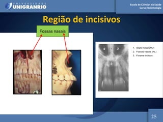 Escola de Ciências da Saúde
Curso: Odontologia
Região de incisivos
1. Septo nasal (RO)
2. Fossas nasais (RL)
3. Forame incisivo
Fossas nasais
25
 