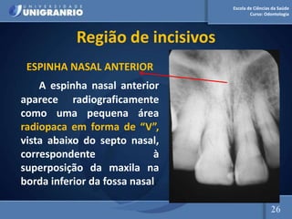 Escola de Ciências da Saúde
Curso: Odontologia
Região de incisivos
ESPINHA NASAL ANTERIOR
A espinha nasal anterior
aparece radiograficamente
como uma pequena área
radiopaca em forma de “V”,
vista abaixo do septo nasal,
correspondente à
superposição da maxila na
borda inferior da fossa nasal.
26
 