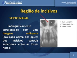 Escola de Ciências da Saúde
Curso: Odontologia
Região de incisivos
SEPTO NASAL
Radiograficamente
apresenta-se com uma
imagem radiopaca
localizada acima dos ápices
dos incisivos centrais
superiores, entre as fossas
nasais.
1. Septo nasal (RO)
2. Fossas nasais (RL)
3. Forame incisivo
27
 