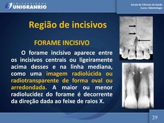 Escola de Ciências da Saúde
Curso: Odontologia
Região de incisivos
FORAME INCISIVO
O forame incisivo aparece entre
os incisivos centrais ou ligeiramente
acima desses e na linha mediana,
como uma imagem radiolúcida ou
radiotransparente de forma oval ou
arredondada. A maior ou menor
radiolucidez do forame é decorrente
da direção dada ao feixe de raios X.
29
 