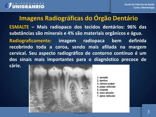 Escola de Ciências da Saúde
Curso: Odontologia
Imagens Radiográficas do Órgão Dentário
ESMALTE – Mais radiopaco dos tecidos dentários: 96% das
substâncias são minerais e 4% são materiais orgânicos e água.
Radiograficamente: imagem radiopaca bem definida
recobrindo toda a coroa, sendo mais afilada na margem
cervical. Seu aspecto radiográfico de contorno contínuo é um
dos sinais mais importantes para o diagnóstico precoce de
cárie.
1. esmalte
2. dentina
3. câmara pulpar
4. polpa radicular
5. cúspide
6. osso alveolar
7. ápice radicular
3
 