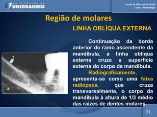 Escola de Ciências da Saúde
Curso: Odontologia
Região de molares
LINHA OBLÍQUA EXTERNA
Continuação da borda
anterior do ramo ascendente da
mandíbula, a linha oblíqua
externa cruza a superfície
externa do corpo da mandíbula.
Radiograficamente,
apresenta-se como uma faixa
radiopaca, que cruza
transversalmente, o corpo da
mandíbula à altura de 1/3 médio
das raízes de dentes molares.
31
 