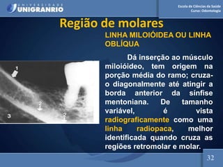 Escola de Ciências da Saúde
Curso: Odontologia
Região de molares
LINHA MILOIÓIDEA OU LINHA
OBLÍQUA
Dá inserção ao músculo
miloióideo, tem origem na
porção média do ramo; cruza-
o diagonalmente até atingir a
borda anterior da sínfise
mentoniana. De tamanho
variável, é vista
radiograficamente como uma
linha radiopaca, melhor
identificada quando cruza as
regiões retromolar e molar.
32
 