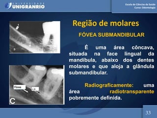 Escola de Ciências da Saúde
Curso: Odontologia
Região de molares
FÓVEA SUBMANDIBULAR
É uma área côncava,
situada na face lingual da
mandíbula, abaixo dos dentes
molares e que aloja a glândula
submandibular.
Radiograficamente: uma
área radiotransparente
pobremente definida.
Fóvea
L O
33
 