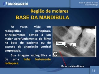 Escola de Ciências da Saúde
Curso: Odontologia
Região de molares
Ás vezes, vista em
radiografias periapicais,
principalmente devido a um
maior aprofundamento do filme
na boca do paciente ou do
excesso da angulação vertical
empregada.
Sua imagem radiográfica é
de uma linha fortemente
radiopaca.
Fóvea
L O
Base da Mandíbula
BASE DA MANDIBULA
34
 