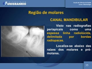 Escola de Ciências da Saúde
Curso: Odontologia
Região de molares
CANAL MANDIBULAR
Visto nas radiografias
periapicais como uma
espessa linha radiolúcida,
delimitada por bordas
radiopacas.
Localiza-se abaixo das
raízes dos molares e pré-
molares.
35
 