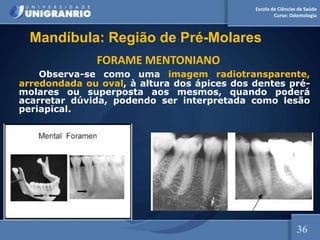Escola de Ciências da Saúde
Curso: Odontologia
FORAME MENTONIANO
Observa-se como uma imagem radiotransparente,
arredondada ou oval, à altura dos ápices dos dentes pré-
molares ou superposta aos mesmos, quando poderá
acarretar dúvida, podendo ser interpretada como lesão
periapical.
36
Mandíbula: Região de Pré-Molares
 