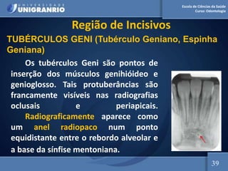 Escola de Ciências da Saúde
Curso: Odontologia
Região de Incisivos
Os tubérculos Geni são pontos de
inserção dos músculos genihióideo e
genioglosso. Tais protuberâncias são
francamente visíveis nas radiografias
oclusais e periapicais.
Radiograficamente aparece como
um anel radiopaco num ponto
equidistante entre o rebordo alveolar e
a base da sínfise mentoniana.
39
TUBÉRCULOS GENI (Tubérculo Geniano, Espinha
Geniana)
 