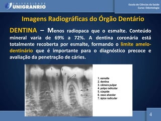 Escola de Ciências da Saúde
Curso: Odontologia
Imagens Radiográficas do Órgão Dentário
DENTINA – Menos radiopaca que o esmalte. Conteúdo
mineral varia de 69% a 72%. A dentina coronária está
totalmente recoberta por esmalte, formando o limite amelo-
dentinário que é importante para o diagnóstico precoce e
avaliação da penetração de cáries.
1. esmalte
2. dentina
3. câmara pulpar
4. polpa radicular
5. cúspide
6. osso alveolar
7. ápice radicular
4
 