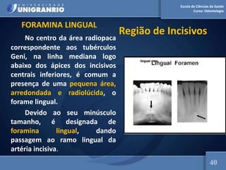 Escola de Ciências da Saúde
Curso: Odontologia
Região de Incisivos
FORAMINA LINGUAL
No centro da área radiopaca
correspondente aos tubérculos
Geni, na linha mediana logo
abaixo dos ápices dos incisivos
centrais inferiores, é comum a
presença de uma pequena área,
arredondada e radiolúcida, o
forame lingual.
Devido ao seu minúsculo
tamanho, é designada de
foramina lingual, dando
passagem ao ramo lingual da
artéria incisiva.
40
 