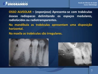 Escola de Ciências da Saúde
Curso: Odontologia
OSSO ALVEOLAR – (esponjoso) Apresenta-se com trabéculas
ósseas radiopacas delimitando os espaços medulares,
radiolúcidos ou radiotransparentes.
Na mandíbula as trabéculas apresentam uma disposição
horizontal.
Na maxila as trabéculas são irregulares.
7
 