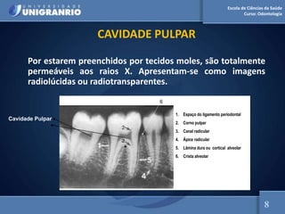 Escola de Ciências da Saúde
Curso: Odontologia
CAVIDADE PULPAR
Por estarem preenchidos por tecidos moles, são totalmente
permeáveis aos raios X. Apresentam-se como imagens
radiolúcidas ou radiotransparentes.
1. Espaço do ligamento periodontal
2. Corno pulpar
3. Canal radicular
4. Ápice radicular
5. Lâmina dura ou cortical alveolar
6. Crista alveolar
6
Cavidade Pulpar
8
 